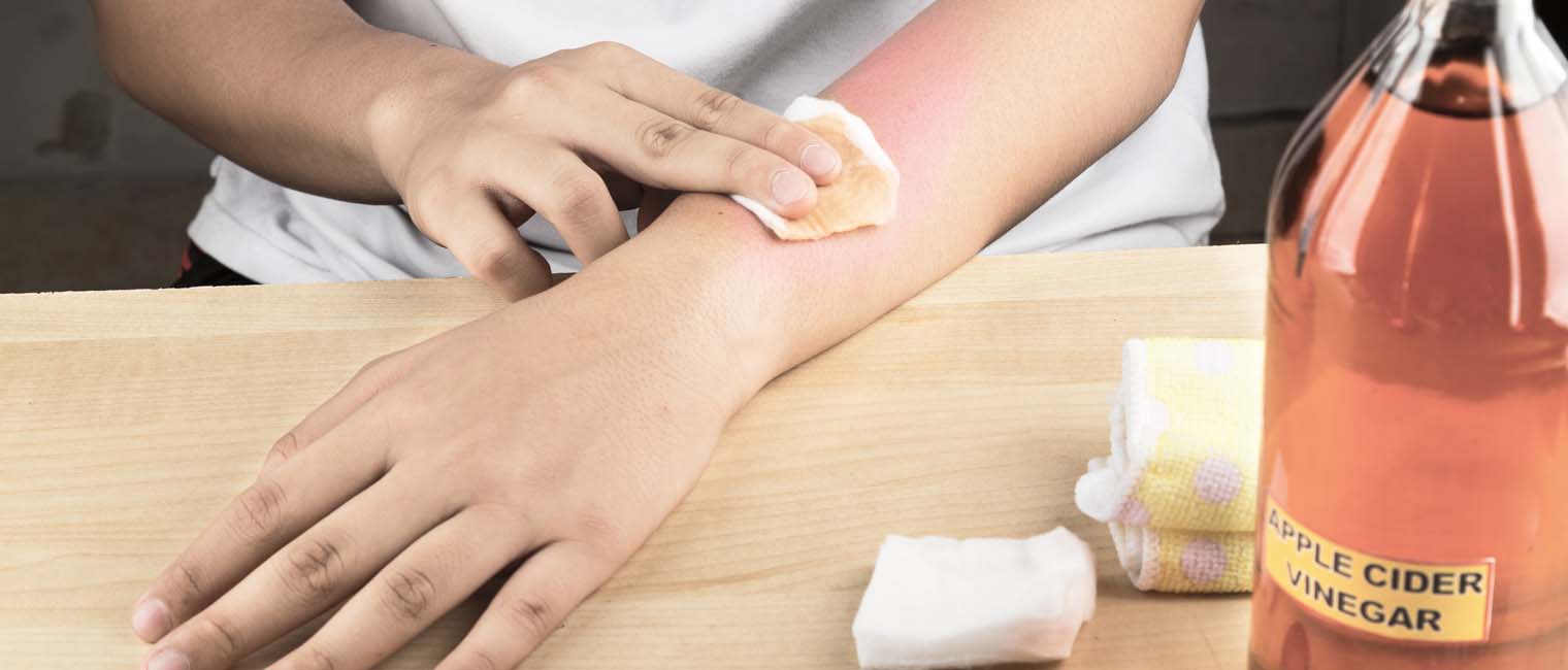 applying treatment to reddish skin on arm